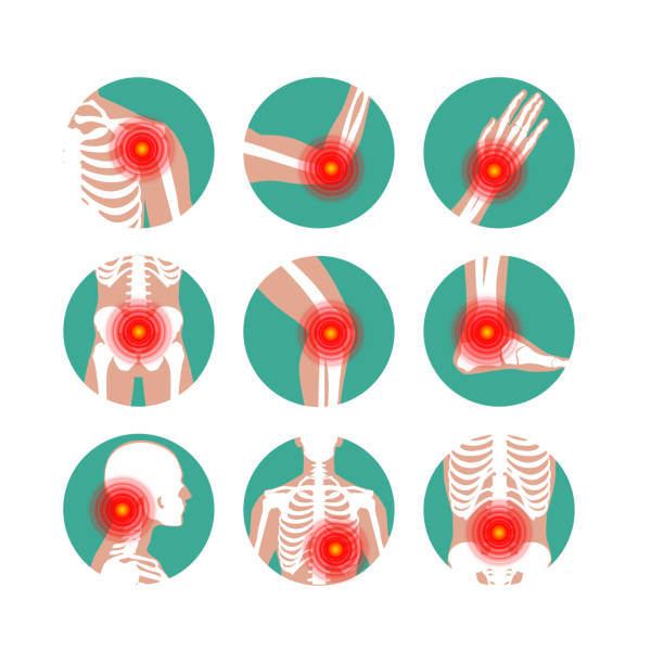 ilustrações, clipart, desenhos animados e ícones de reumatismo ou desordem reumática médica definida. dor nas articulações artrite. infografia de vetor de reumatologia - rheumatic