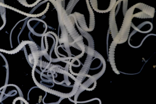 istock The study of Tapeworm infection is caused by ingesting food or water contaminated with tapeworm eggs or larvae in laboratory. 1128929231