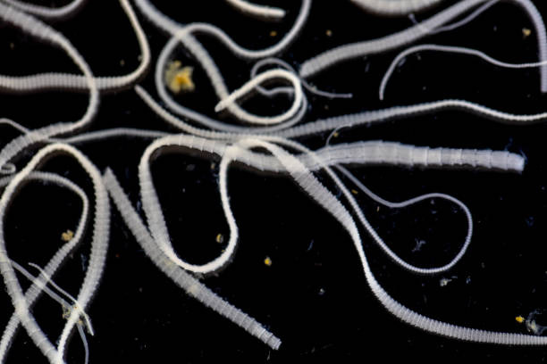istock The study of Tapeworm infection is caused by ingesting food or water contaminated with tapeworm eggs or larvae in laboratory. 1128929241