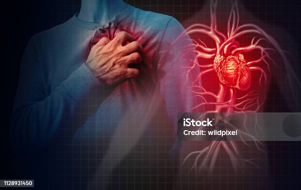 Heart Attack Concept Stock Photo - Download Image Now - Heart Attack, Heart Disease, Infarction