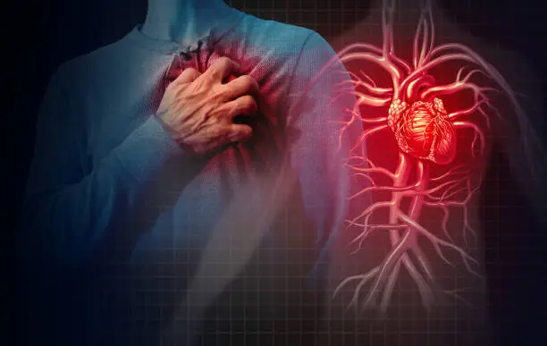 Heart attack concept and human cardiovascular pain as an anatomy medical disease concept with a person suffering from a cardiac illness as a painful coronary event with 3D illustration style elements.