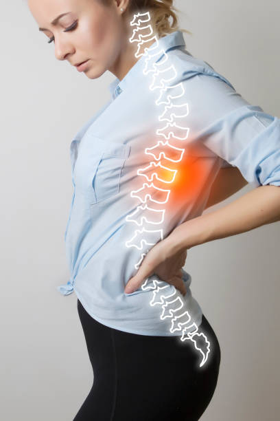 woman figure photo with illustration of spine woman figure photo with illustration of spine / scoliosis / spine injury cerebrospinal fluid photos stock pictures, royalty-free photos & images