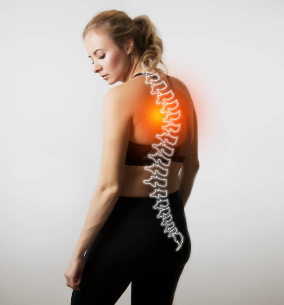woman figure photo with illustration of spine woman figure photo with illustration of spine / highlighted pain / scoliosis cerebrospinal fluid photos stock pictures, royalty-free photos & images
