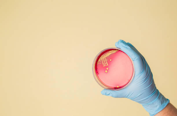 mano sostiene la placa de petri con las bacterias del estafilococo - staphylococcus petri dish bacterium biology fotografías e imágenes de stock