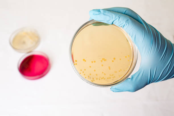 Hand holds Petri dish with E.coli Escherichia bacteria. Lab testing for infection.Staphylococcus aureus bacterial colony culture growth, gram-negative gram-positive cocci bacilli, alpha beta hemolysis