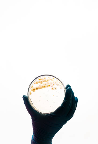 Hand holds Petri dish with E.coli Escherichia bacteria. Lab testing for intestinal infection.Bacterial colony culture growth in yellow agar plate, gram-negative cocci bacilli growing, alpha hemolysis