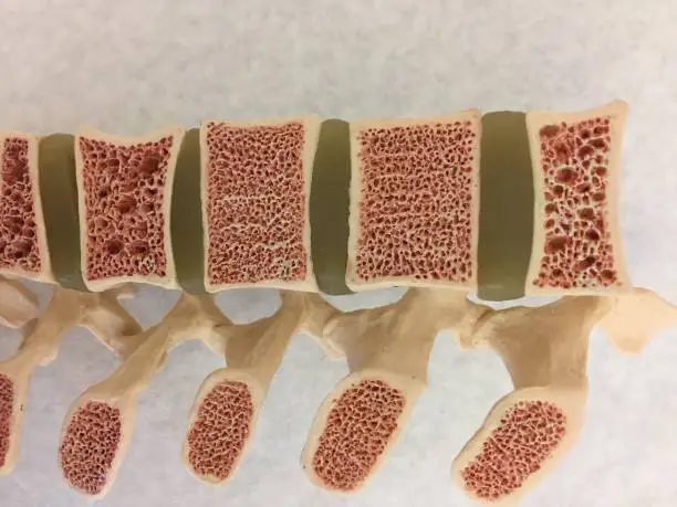 Old anatomical model of spinal column, vertebral discs and bodies and spinal processes