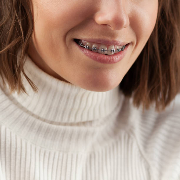 istock Young beautiful woman with braces 1129222935