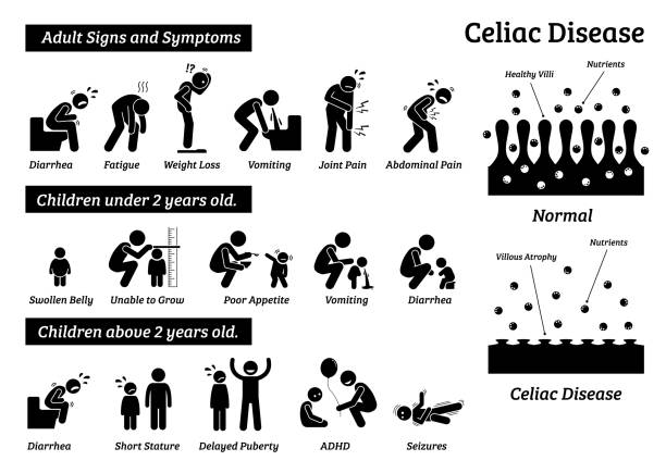 Celiac disease signs and symptoms. Illustrations depict celiac disease problems in adult and children. malnourished stock illustrations