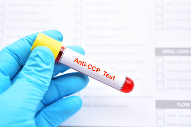 Blood sample tube for anti-CCP test Blood sample tube for anti-CCP test, diagnosis for rheumatoid arthritis disease autoantibody stock pictures, royalty-free photos & images
