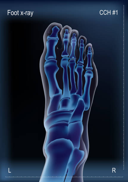 kuvapankkikuvitukset aiheesta luiden röntgenkuva jalan - kantaluu