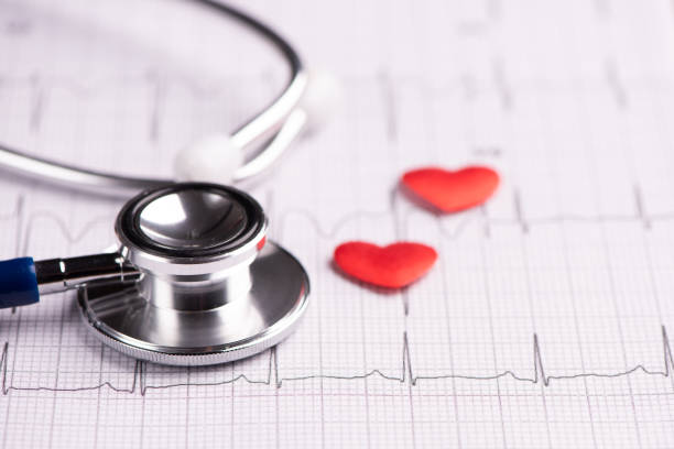 istock A stethoscope on ecg medical report 1129579518