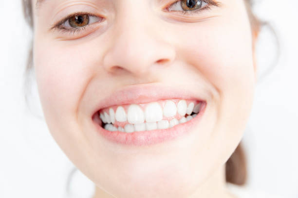 istock Young girl beautiful smile with white teeth 1129618486