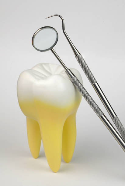 istock Tooth and dental tools. Tooth health, conceptual image. 1129663831