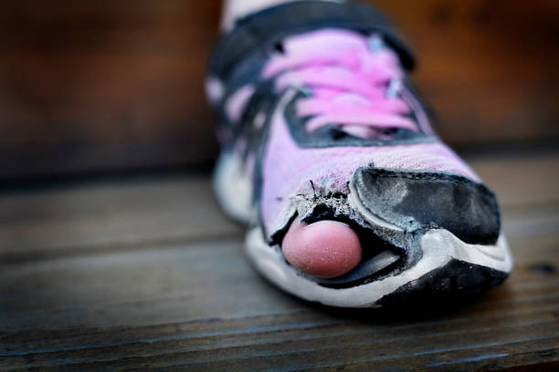 homeless child wearing old worn out shoes on feet with holes in them toes sticking out - unusable imagens e fotografias de stock