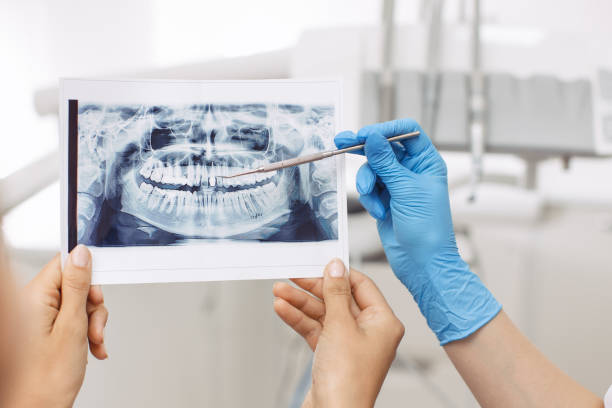 Dentist showing X-ray image to patient stock photo