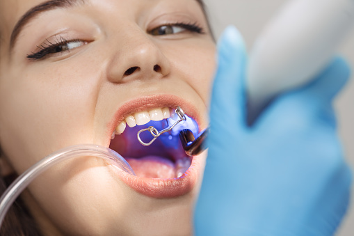 Dentist doing a dental treatment on a female patient. Surgery close-up.