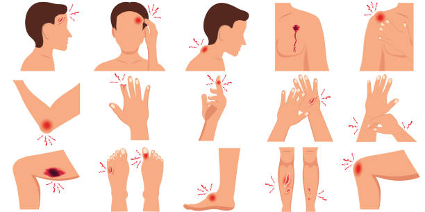 ból w części ludzkiego ciała uszkodzenia ciała płaski zestaw. - wound blood human finger physical injury stock illustrations