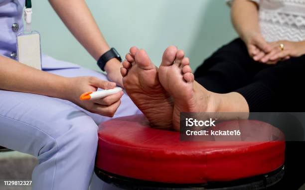 The Doctor Examines The Nerve Response With Monofilament Odiatrist Treating Feet During Procedure Stock Photo - Download Image Now