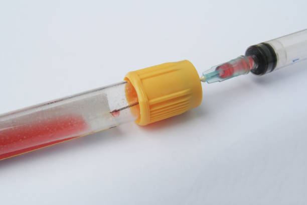 istock Laboratory blood sample. Laboratory test tube and syringe with blood sample. 1129954418