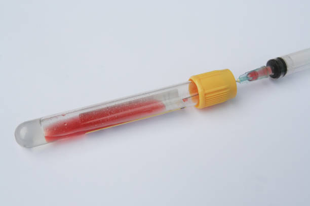 istock Laboratory blood sample. Laboratory test tube and syringe with blood sample. 1129954436