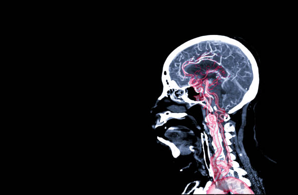 la angiografía de ct del cerebro o cta vista sagital del cerebro. - computed fotografías e imágenes de stock