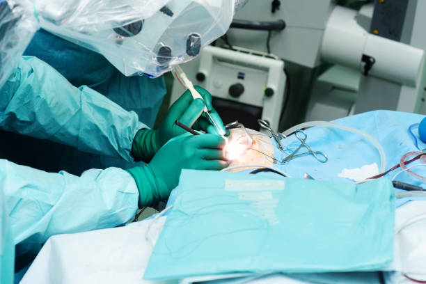 neurosurgeons perform surgery to excise a brain tumor stock photo