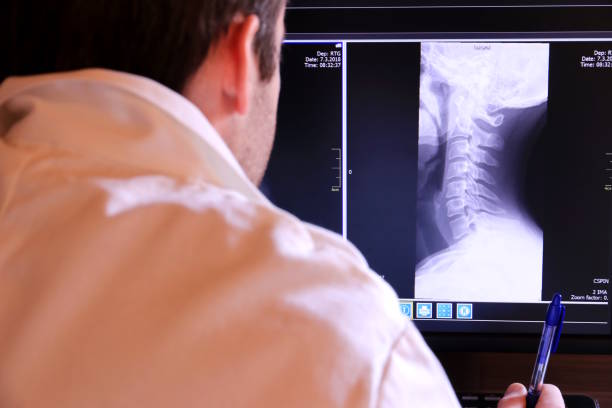 x 線像の分析 - human spine mri scan x ray doctor ストックフォトと画像