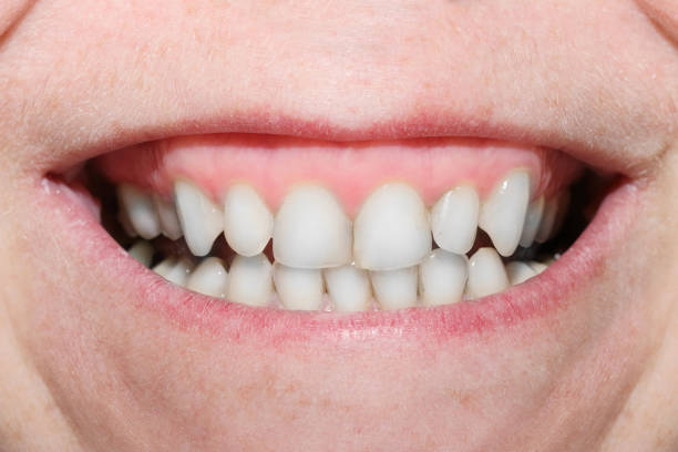 istock Close up a big mouth showing a  teeth. 1130353424