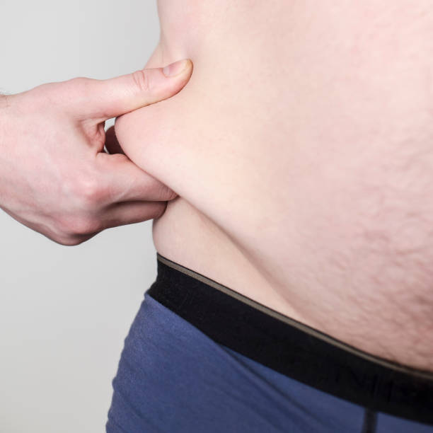 istock overweight person pinches himself on the fat side 1130355387