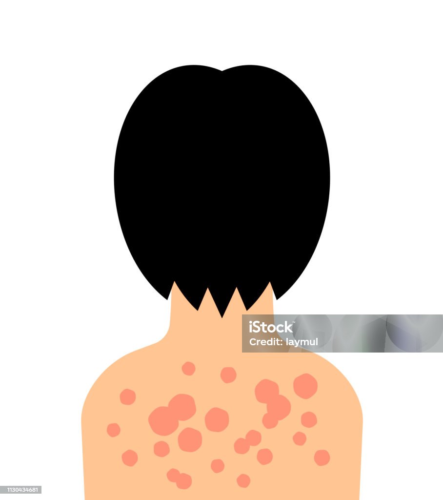 Giời Leo Hình minh họa Sẵn có - Tải xuống Hình ảnh Ngay bây giờ ...