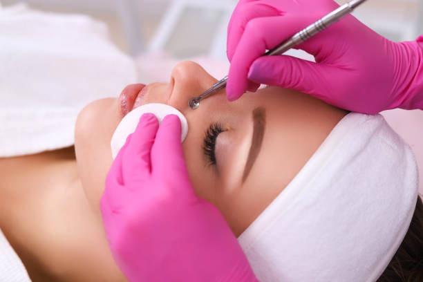 istock Professional cleansing of acne in a beauty salon. 1130466310