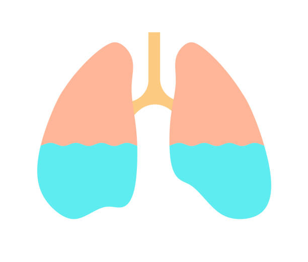 ilustrações de stock, clip art, desenhos animados e ícones de the lung on which water collected - 3679