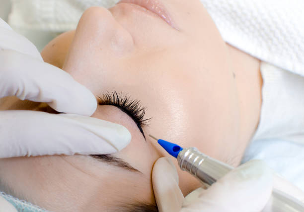 istock Cosmetologist applying permanent make up eyeliner Permanent make-up tattoo 1130645073