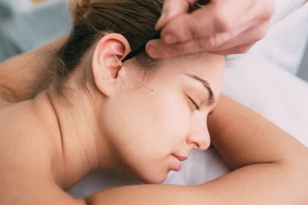 istock Acupuncturist inserting a needle into a female face 1130730039