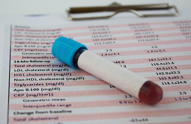 cholesterol test cholesterol and blood test results in laboratory. cholesterol screening stock pictures, royalty-free photos & images