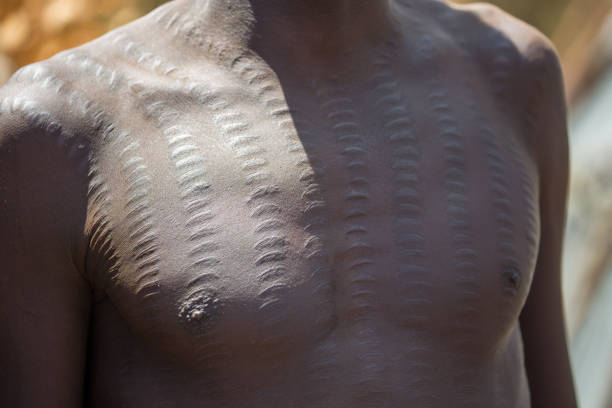 Ethiopia: Daasanach Scars Detail of scarring on the body of a Daasanach man. The patterns of scars are a popular tradition in numerous tribes in the Omo Valley. scarification stock pictures, royalty-free photos & images