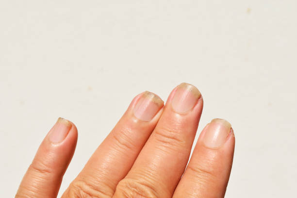 istock Fingers and black dirt in the nails 1130842631