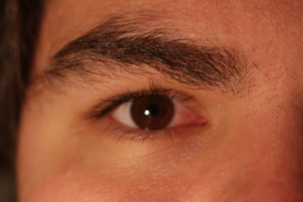 istock male brown eye with thick eye brows and red skin 1130970983