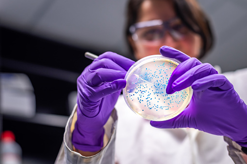 mujer investigadora que realiza el examen de la placa de cultivo bacteriano photo
