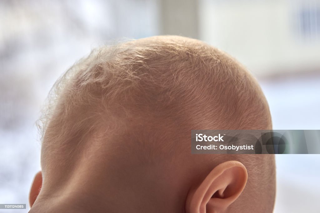 Childrens Nape With Sparse White Hair Closeup Stock Photo - Download Image  Now - Baby - Human Age, Hair, Above - iStock