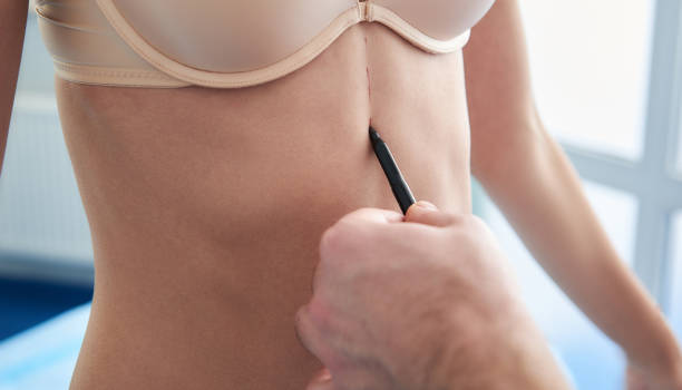 istock Doctor drawing dotted line on body with marker 1131130172