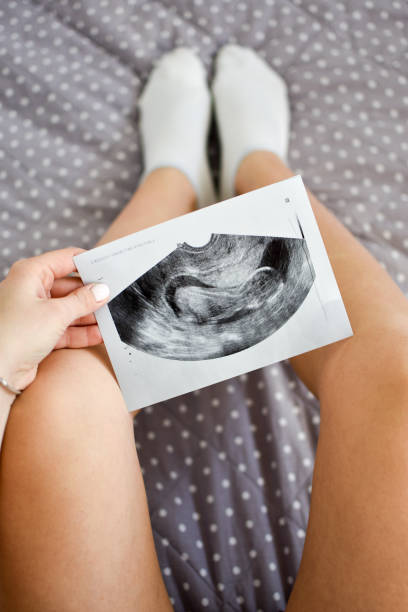 istock Pregnant in bed 1131182858