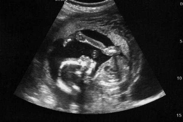 ultrasonido con embarazo obstétrico de feto imágenes médicas. madre embarazada. - fetus fotografías e imágenes de stock