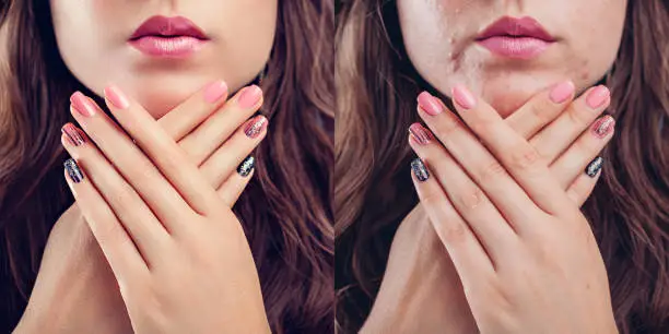 Before and after retouching in editor. Side by side fashion portraits of woman with makeup and manicure edited