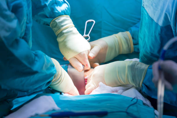 istock Detail from surgical opertion 1131671729