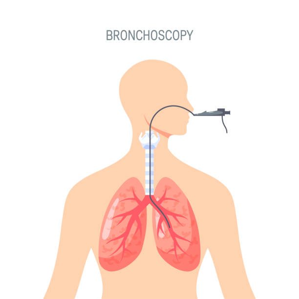 lunge diagnostische vektorkonstruktion im flachen stil - endoskop stock-grafiken, -clipart, -cartoons und -symbole