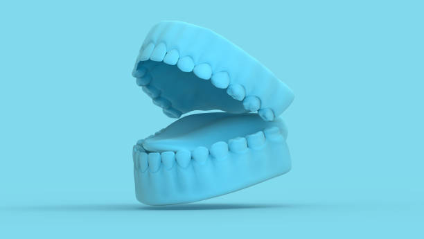 moule 3d dent et gomme ouvert sur le modèle bleu pastel bg - teeth model photos et images de collection