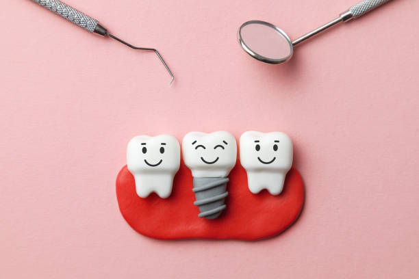 istock Healthy white teeth and implants are smiling on pink background and dentist tools mirror, hook. 1131770422
