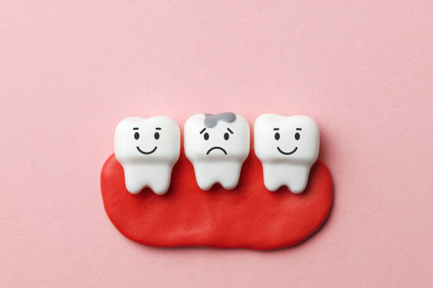 istock Healthy white teeth are smiling and tooth with caries is sad on pink background. 1131771078